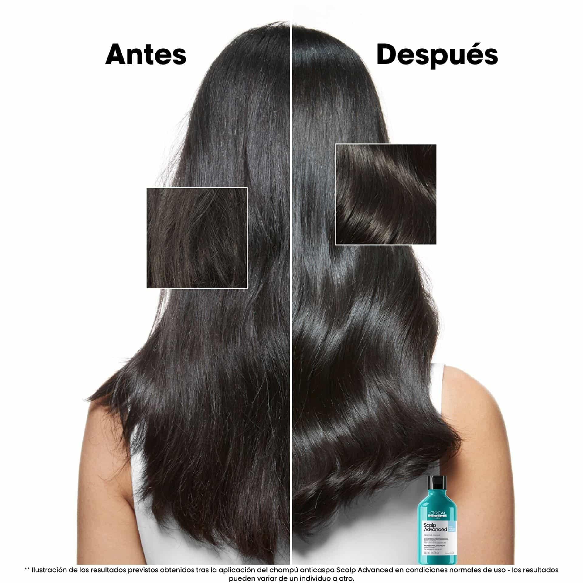 Champú Anti Caspa Scalp 300 ml