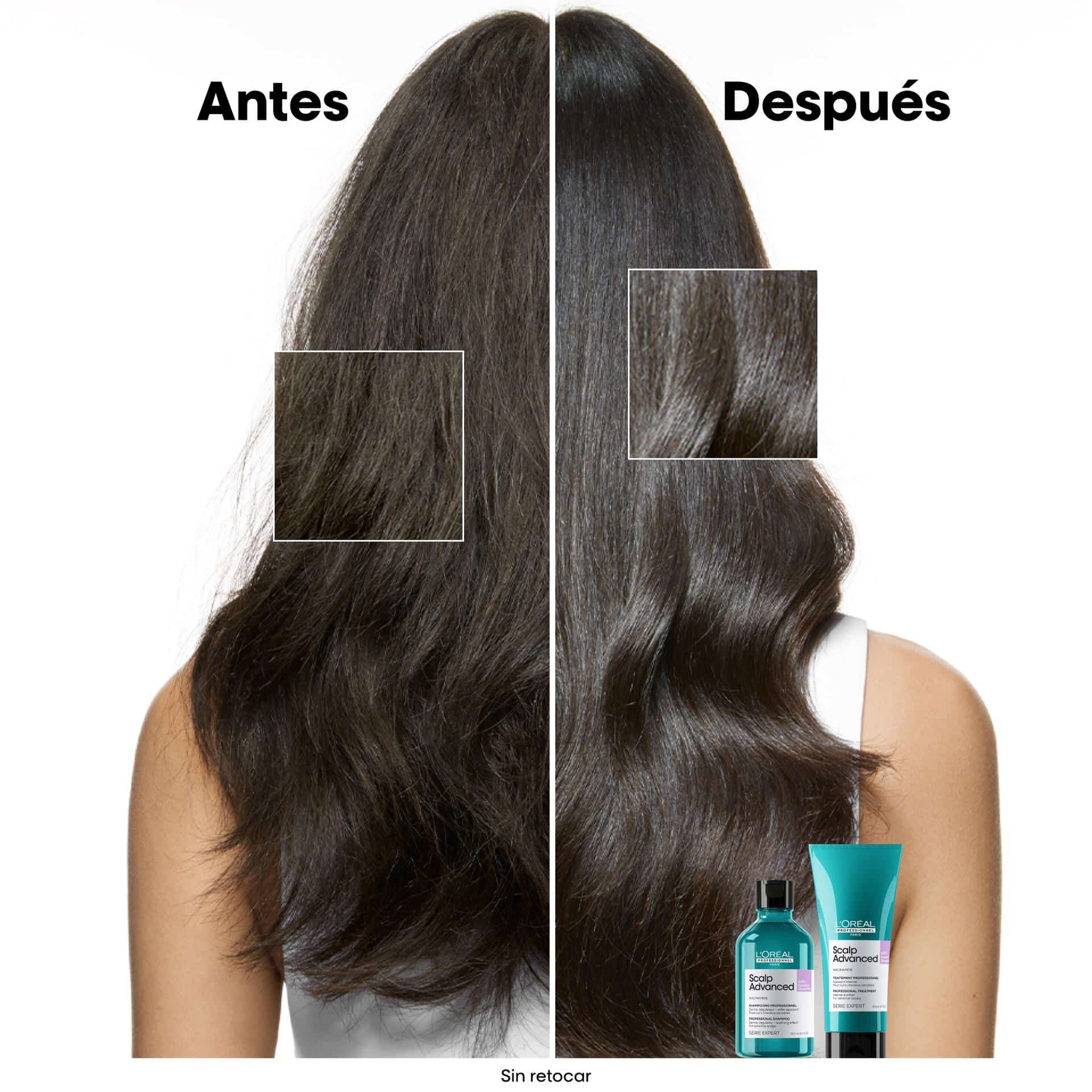 Champú Scalp antimalestar 300 ml