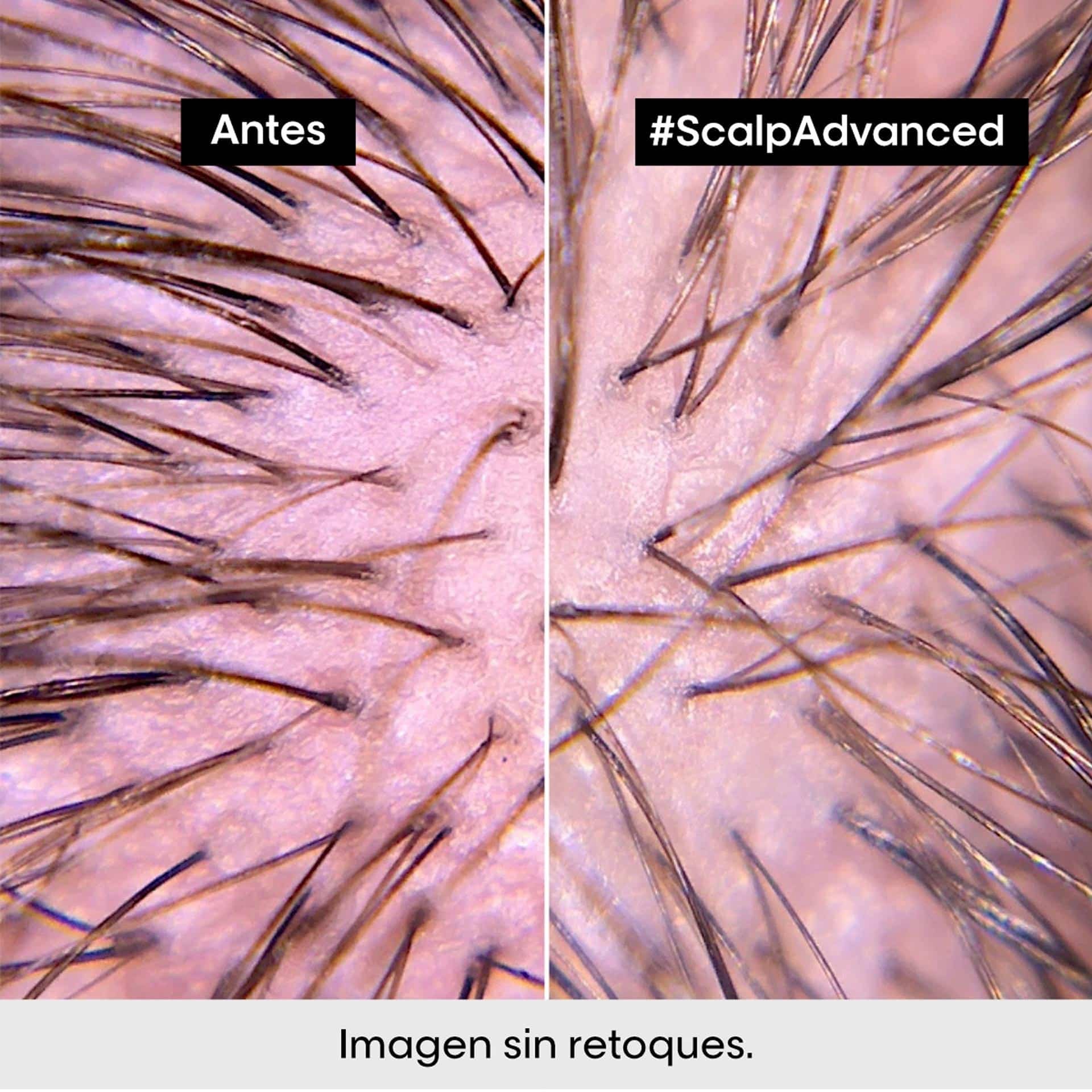 Acondicionador Scalp Advanced Anti Malestar 200ml