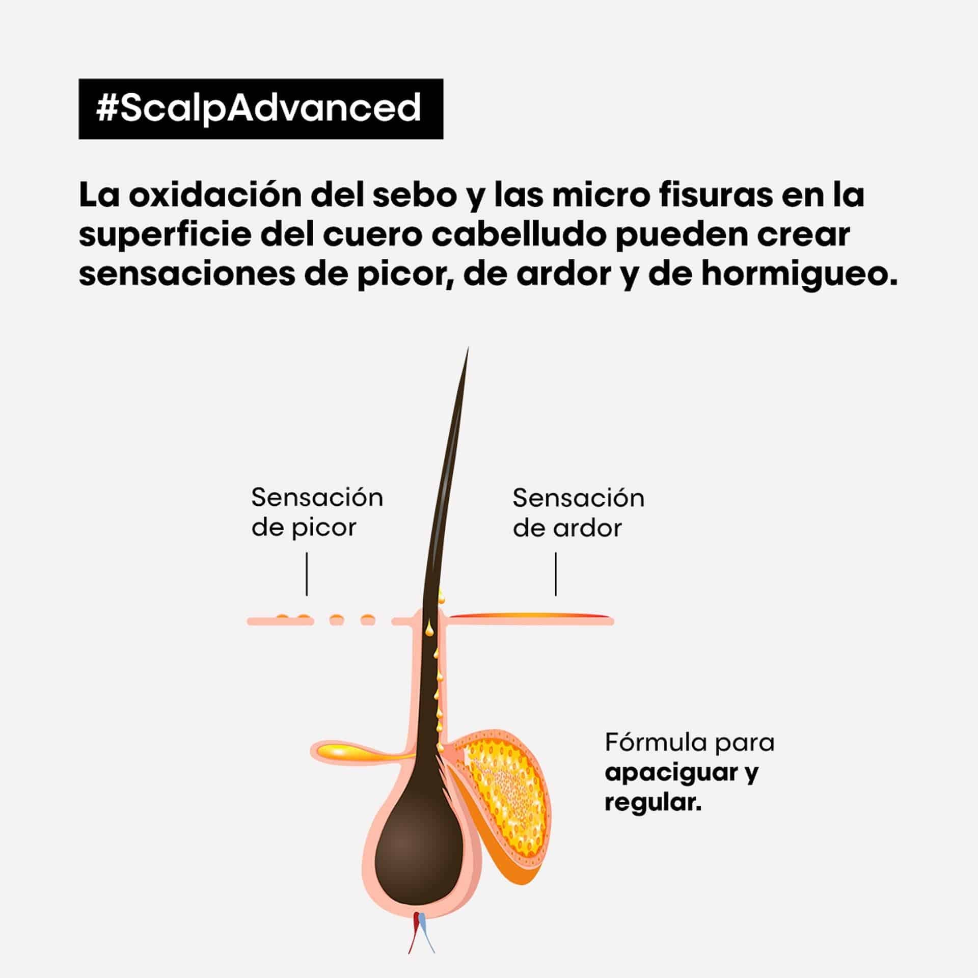 Acondicionador Scalp Advanced Anti Malestar 200ml
