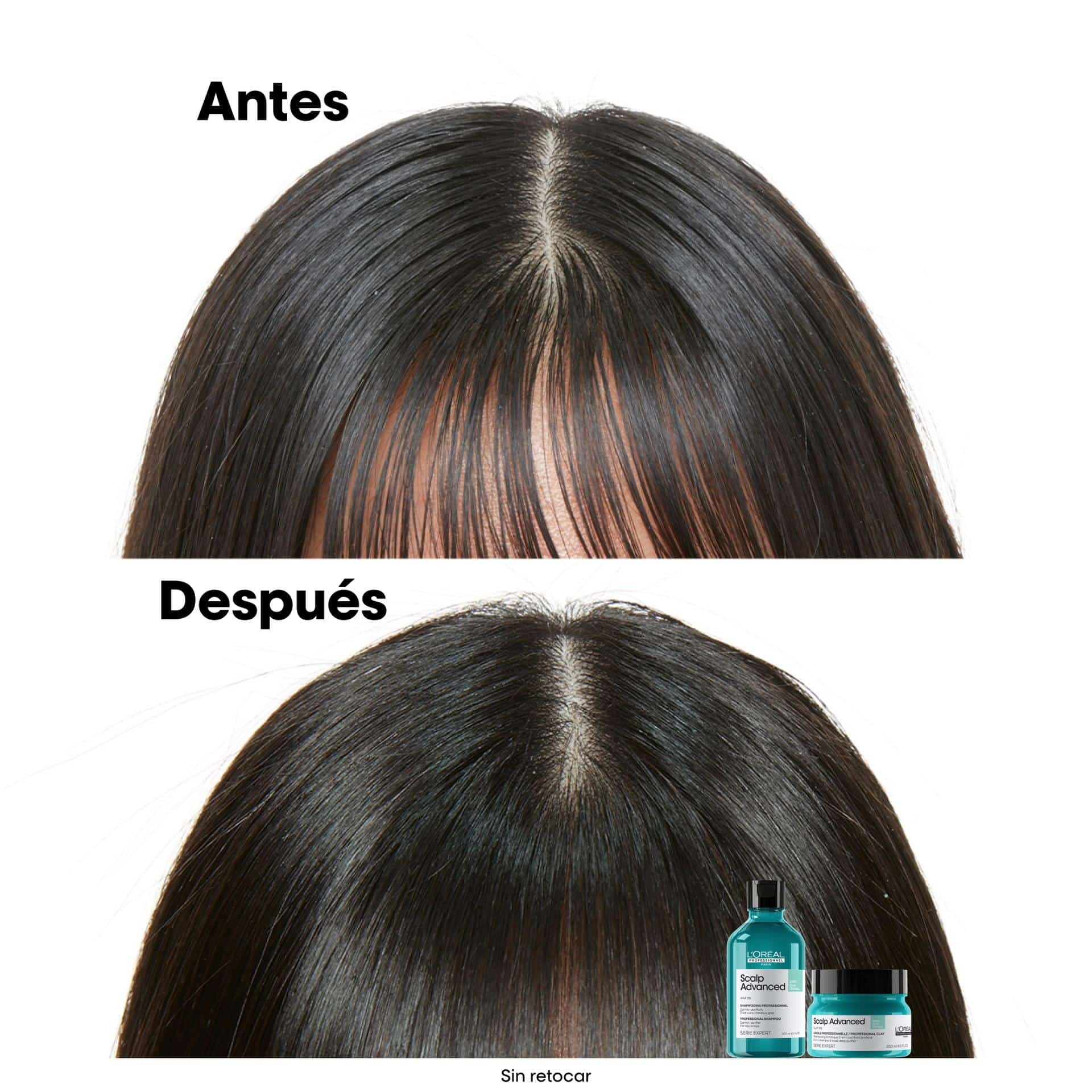 Arcilla Scalp 250 ml