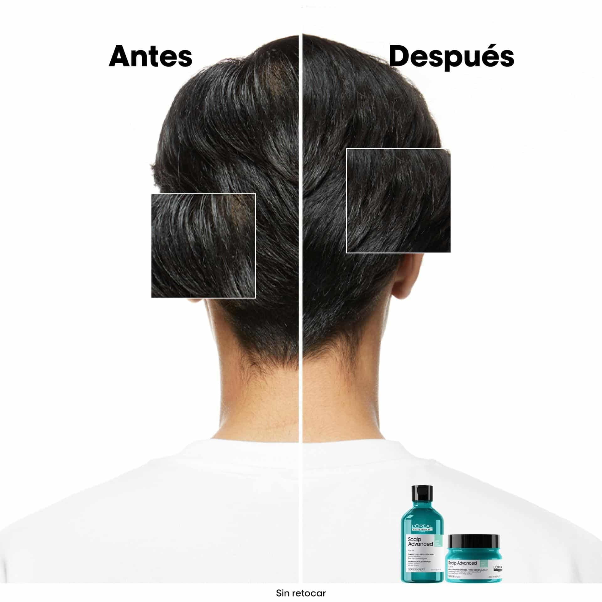 Arcilla Scalp 250 ml