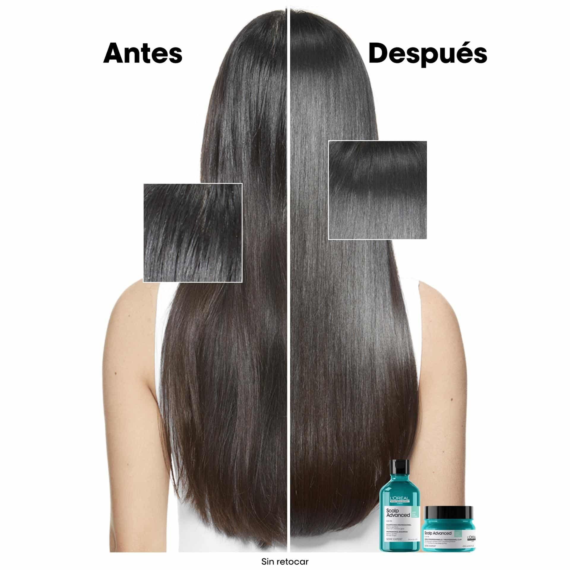 Champú Scalp Anti Grasa 300 ml