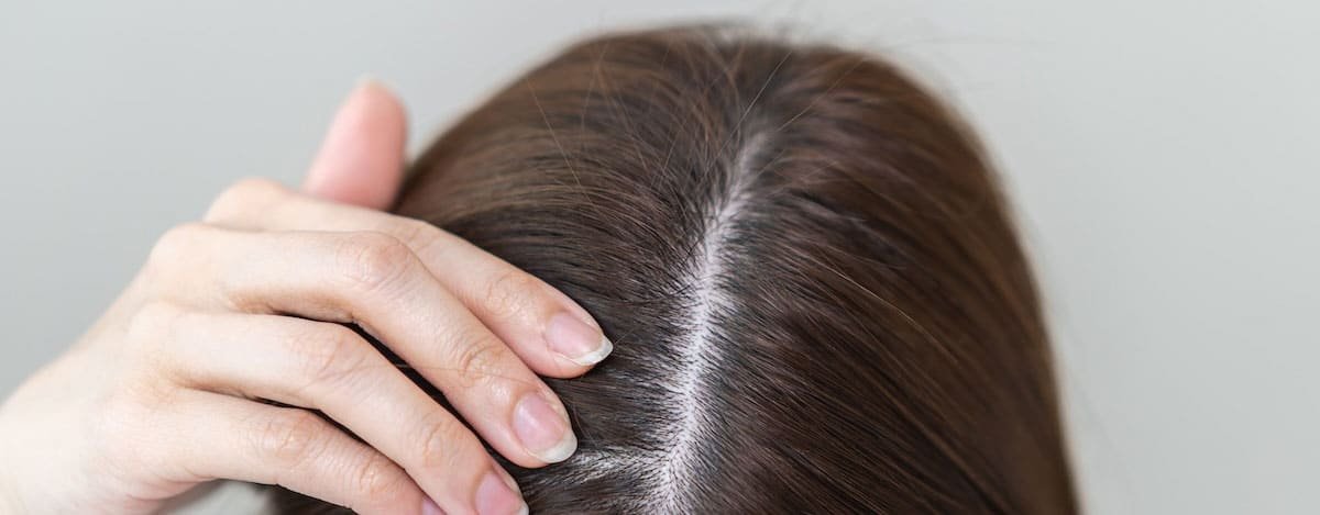Imagen raices de cabello de mujer