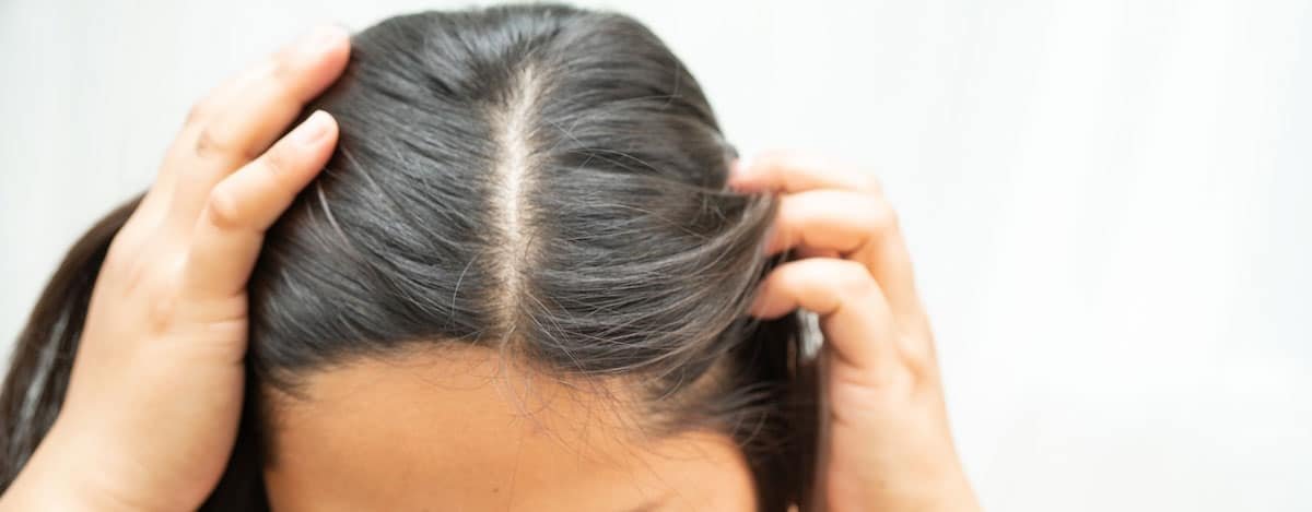 Imagen de raices sensibles en el cabello de mujer