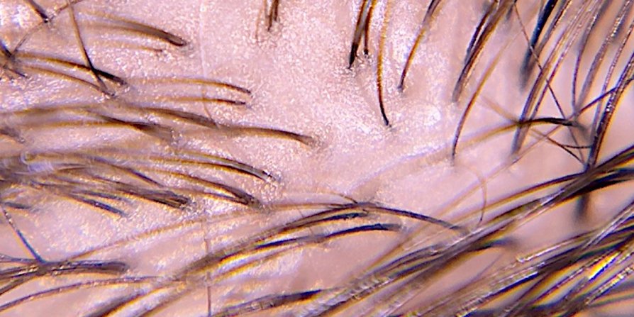 El enfoque se centra en el cuero cabelludo graso, mostrando cómo detener el cabello graso, cuáles pueden ser sus causas y consejos para mantener un cabello fresco y saludable.