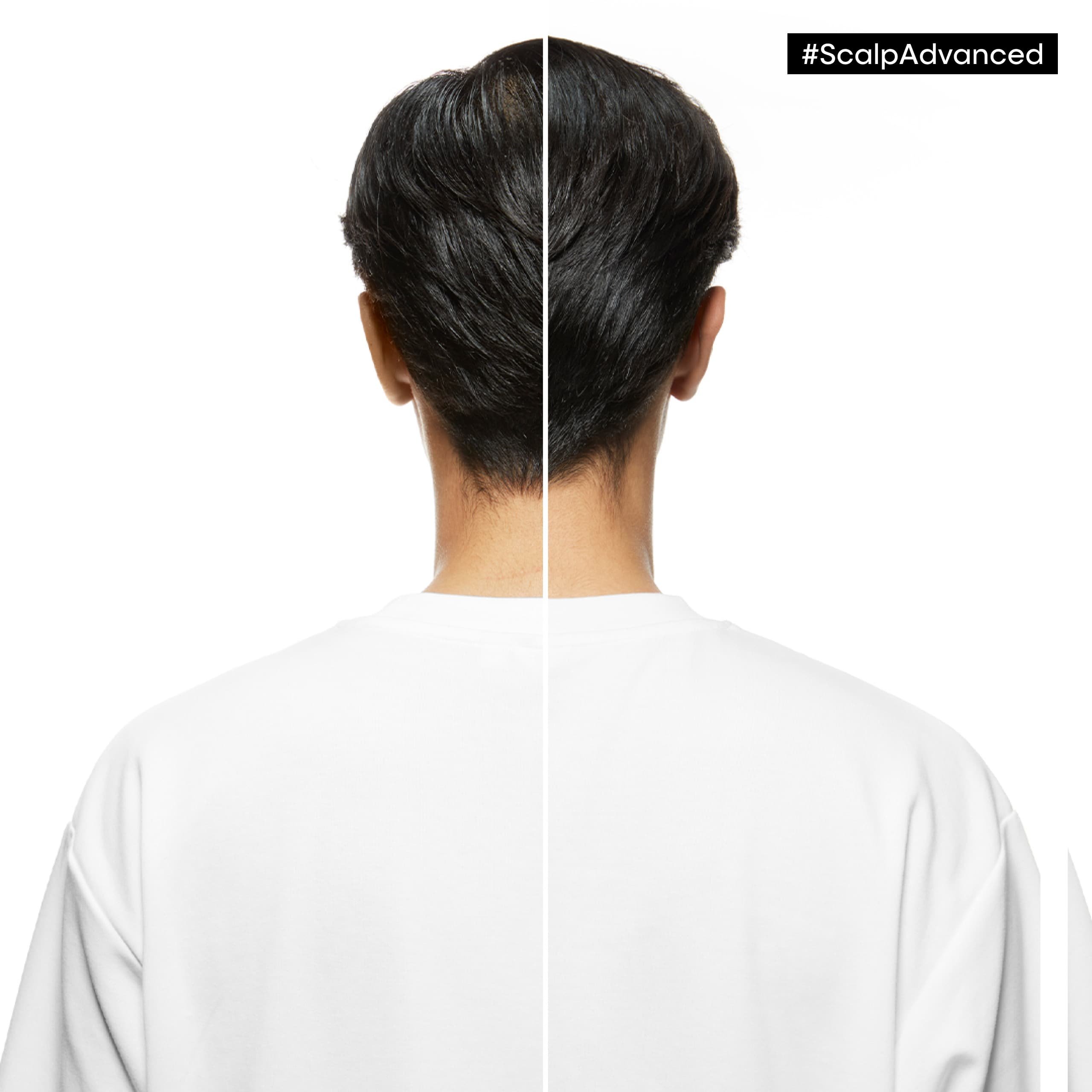 block-serie-expert-refills-2025-06-before-after-3